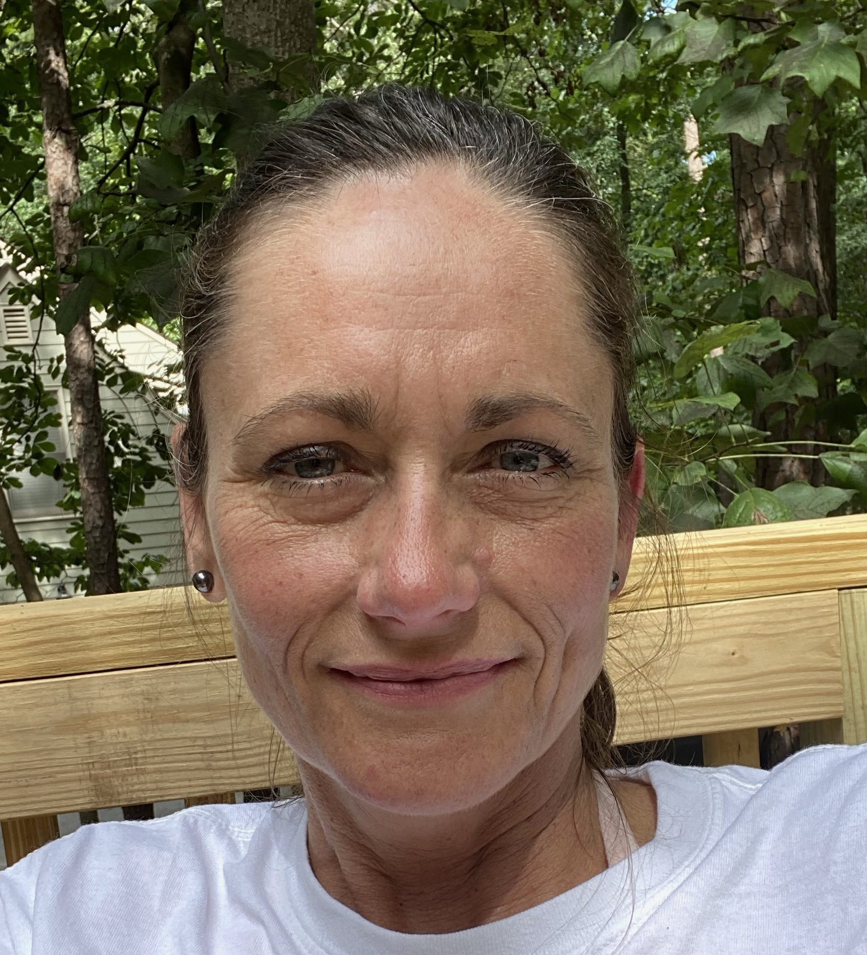 Woman sitting outdoors, surrounded by trees.